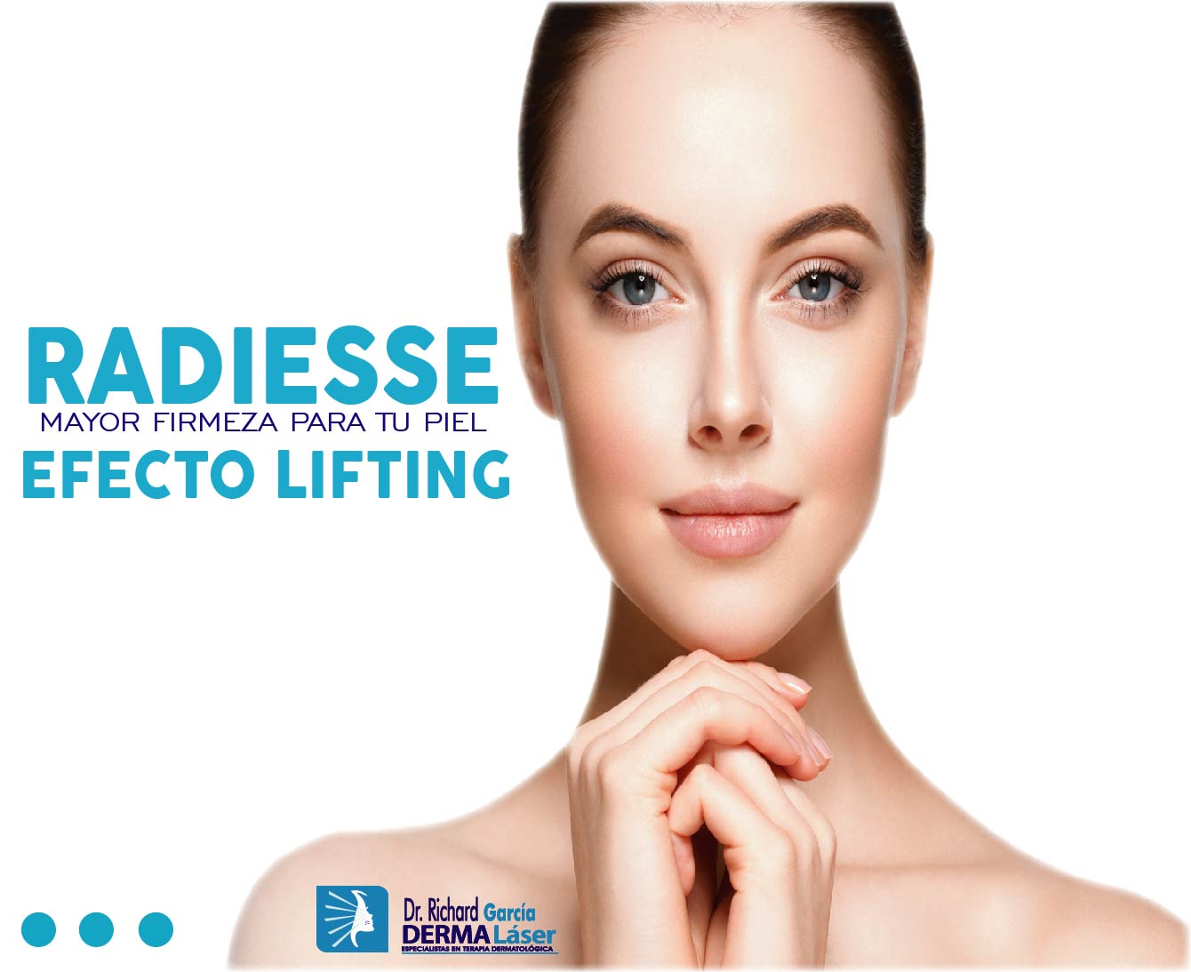 Radiesse Efecto Lifting